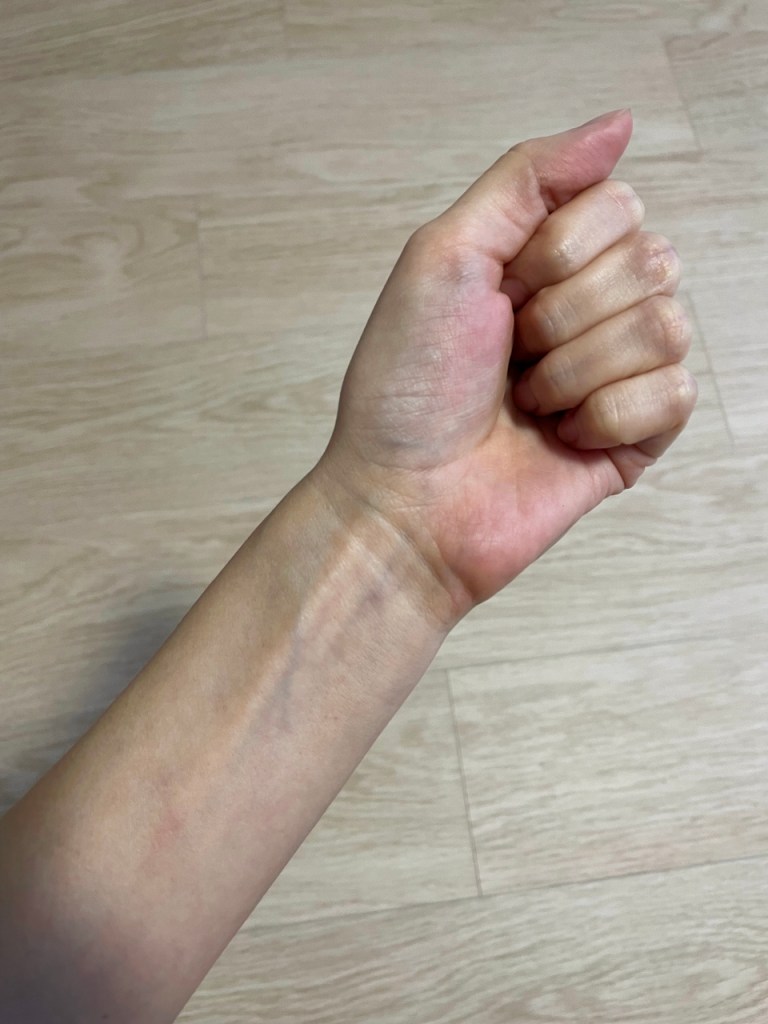 My bare arm with nothing on it